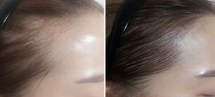 鄭州芳藝醫(yī)療整形醫(yī)院有沒有特色項目？如何一鍵獲取？