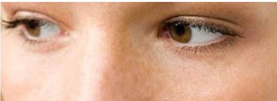 想改善雙眼皮？來鄭州三院看看王江允！了解費用可參考2023價格表。