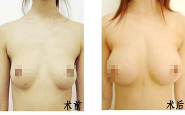 遂寧伊莎貝拉醫(yī)學(xué)美容門診部醫(yī)生是否值得信賴？他們的專業(yè)素質(zhì)如何？