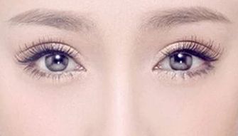 2023年北京哪家醫(yī)院面部拉皮祛皺效果佳？推薦！