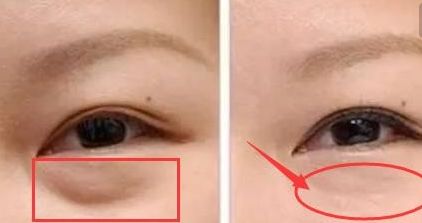 揭秘昆明雙眼皮明星醫(yī)生！驚喜榜單出爐，內(nèi)有杜海寬、王靜等大咖名醫(yī)！