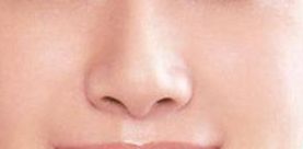 袁斯明醫(yī)生手術(shù)預(yù)約時效如何？祛疤效果有多好？解讀金陵醫(yī)院專家信息！