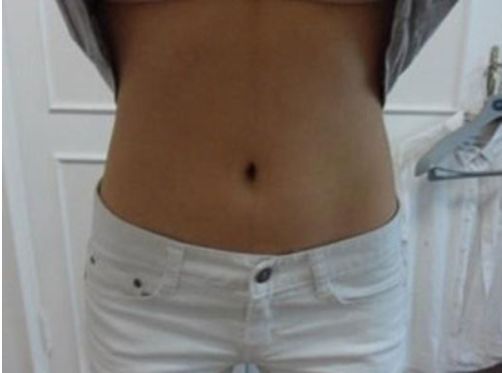 國內(nèi)知名雙眼皮大師推薦名單，附蘇薇潔、魏志香、王世勇等醫(yī)師！