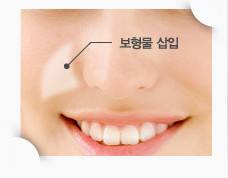 哈爾濱伊尚顏整形醫(yī)院項(xiàng)目如何？醫(yī)生技術(shù)是否可靠？