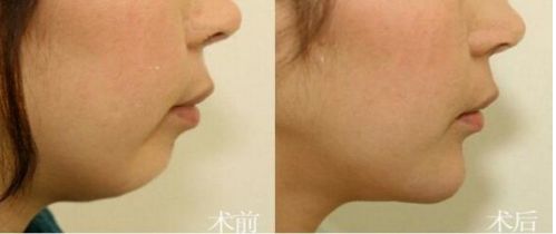 北京市前十名正頜醫(yī)院推薦：八處，協(xié)和，聯(lián)合麗格等，專業(yè)可靠！