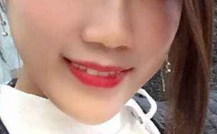 想要做隆鼻手術(shù)如何避免不好的經(jīng)歷？成功隆鼻必備指南！