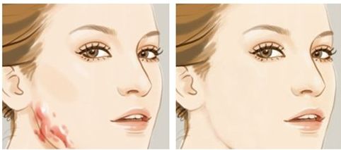 北京黃寺整形醫(yī)生資料及2023鼻部整形收費詳情揭秘！