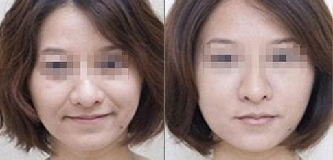 成都有哪些專業(yè)的雙眼皮整形醫(yī)生值得推薦？