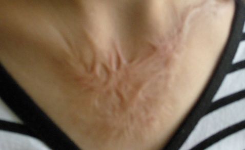 杭州著名雙眼皮醫(yī)生推薦，高口碑為你揭曉