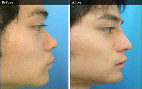 重慶軍科整形醫(yī)院是正規(guī)的嗎？吸脂怎么樣？醫(yī)生口碑評(píng)價(jià)揭曉了，真的靠譜嗎？能否滿足需求？