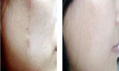 合肥專業(yè)磨骨手術(shù)醫(yī)院：醫(yī)術(shù)精湛，信譽有保障！