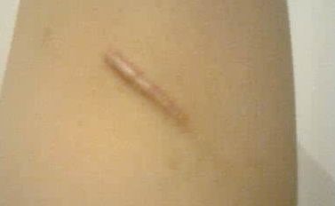 上海顧清整形哪家醫(yī)院好？看看口碑評(píng)價(jià)和隆鼻案例