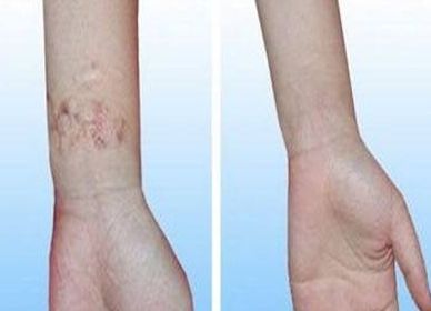 了解邯鄲京美整形醫(yī)生團(tuán)隊(duì)，醫(yī)生介紹及價格表邯鄲京美整形醫(yī)院的醫(yī)生團(tuán)隊(duì)介紹及特色項(xiàng)目與價格