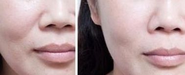 南通割雙眼皮醫(yī)生排行前八名名單公布！五星推薦供參考