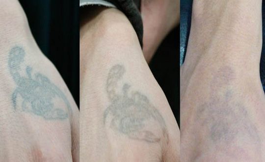 長沙哪家整形醫(yī)院技術(shù)靠譜？私立醫(yī)美還可信嗎？