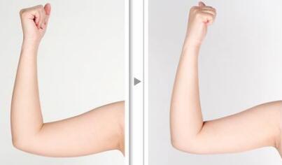 北京新星靚醫(yī)療美容醫(yī)院真的靠譜嗎？李偉民醫(yī)生的資料是怎樣的？