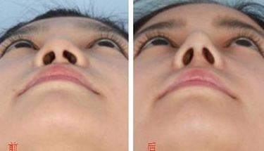 無錫市更受歡迎的吸脂醫(yī)院排行榜2023！這3家醫(yī)院赫然在列