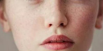 鼻子雕塑：探索華美高順福的鼻部變革效果與實例分享