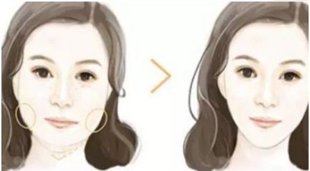 成都哪家口碑整形醫(yī)院好？傾情推薦三家實力不凡的醫(yī)療機(jī)構(gòu)