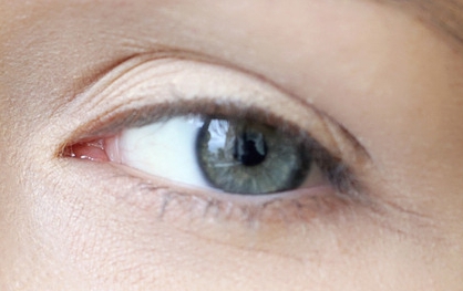 湖州九八醫(yī)院整形科好不好？有沒有適合眼袋的治療方案？