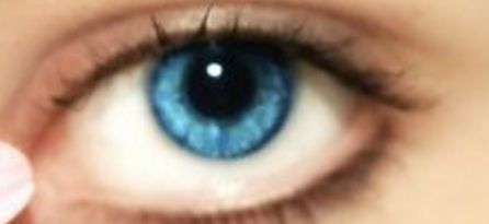 重醫(yī)附一院楊娥_這項(xiàng)技術(shù)為去眼袋法的真人案例值得一看！