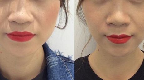 2023年熱議：揭秘重慶市當(dāng)?shù)貥O具口碑的整容醫(yī)院！