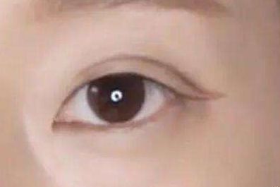 上海九院植發(fā)醫(yī)生劉清簡(jiǎn)介，用心解讀醫(yī)生信息！總結(jié)速查：上海九院植發(fā)醫(yī)師劉清，醫(yī)術(shù)高超！