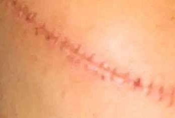 廣州2023年推薦的10位贊譽(yù)卓越的玻尿酸醫(yī)師