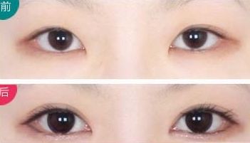 上海最受好評(píng)的乳房整形醫(yī)生推薦！超多病人贊賞王濤、何金光！