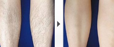 上海頂尖整形外科專家排行榜名單曝光！實(shí)力強(qiáng)弱一目了然！