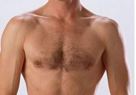 成都整容醫(yī)生吳開泉鼻部整形手術真實案例！