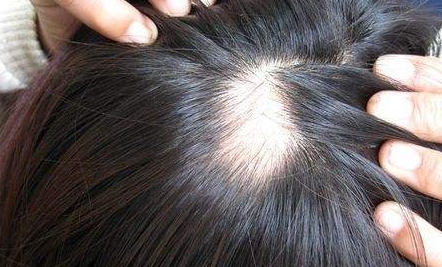 深圳藝星整形醫(yī)院口碑如何？哪位醫(yī)生技術(shù)出眾？收費(fèi)明細(xì)怎么樣？