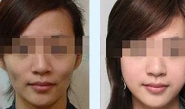 昆明哪家醫(yī)院植發(fā)技術(shù)靠譜？推薦高口碑醫(yī)院給你參考