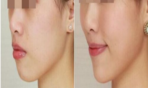 北京最強雙眼皮醫(yī)院推薦，安貞、美萊、八大處霸主爭鋒！