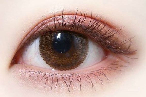 做雙眼皮的技術(shù)及效果，近年治療體驗(yàn)發(fā)布解析