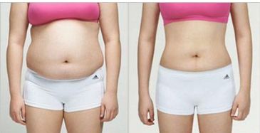 廣州優(yōu)秀整形醫(yī)院排名前三，看看美恩、荔醫(yī)、曙光的口碑如何