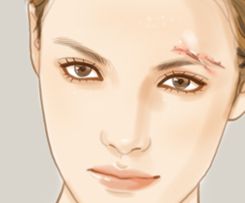 哪家醫(yī)院是國內顴骨整形的佼佼者？九院，華西，西京等整友們贊不絕口！