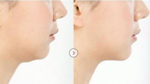 無錫哪家整形醫(yī)院正規(guī)靠譜？2023曼陀羅、伊爾美等名院是首選！