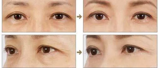 濟(jì)南省立醫(yī)院靚麗容顏新匯價(jià)，專家團(tuán)陣容揭曉