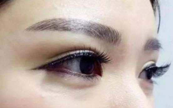 2023年最受認(rèn)可的國(guó)內(nèi)拉皮手術(shù)醫(yī)生排行榜，頂尖專家名單公布