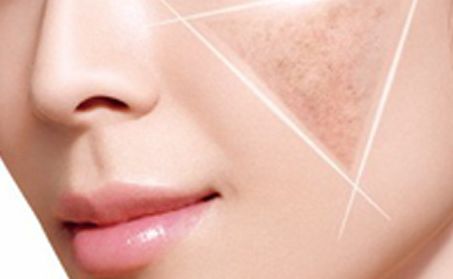 卿勇隆鼻效果如何？專家所屬醫(yī)院披露