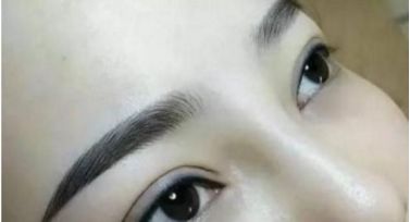 北京哪個醫(yī)院治療胎記效果好？這家醫(yī)院備受推崇