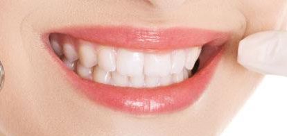 2023年一覽廈門最新雙眼皮醫(yī)療機構(gòu)-替代列表中，星系、顏王等上榜，自主選擇美容服務(wù)！