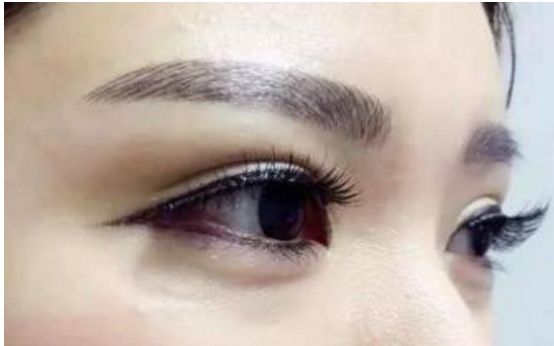 經(jīng)驗(yàn)豐富！華西地區(qū)雙眼皮重點(diǎn)醫(yī)生推薦，名單揭秘！