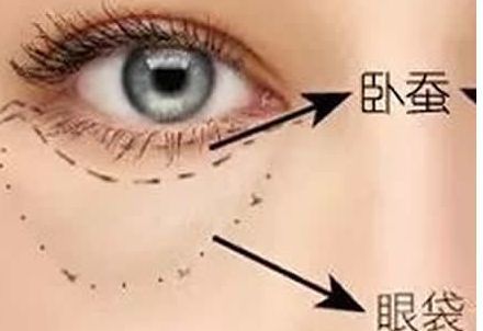 北京協(xié)和醫(yī)院隆胸案例與醫(yī)生簡(jiǎn)介含金量如何？收費(fèi)是否合理？