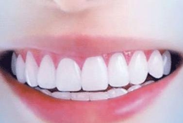 蘇州市立醫(yī)院整形科是否分布在不同的院區(qū)？蘇州市立醫(yī)院整形科在哪些院區(qū)開設(shè)？