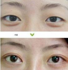 成都哪些醫(yī)生能力出眾進(jìn)行隆胸術(shù)？年度隆胸好醫(yī)生十大排名出爐