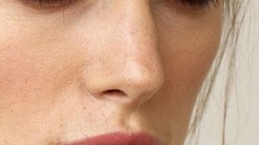 2023年杭州脂肪填充醫(yī)院選擇指南，靜港、時(shí)光等備受推崇