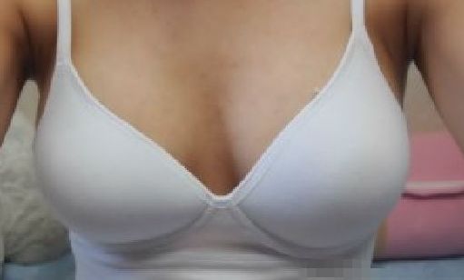 天后朱東磊鼻子整形效果如何？專家評(píng)估結(jié)果公開解析