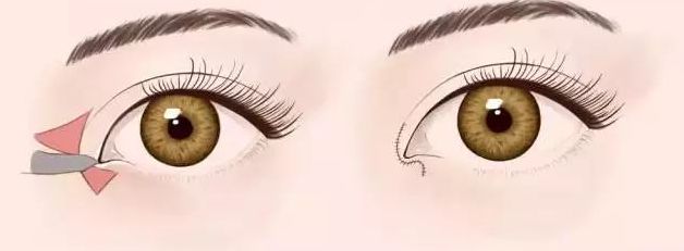 2023年福州整形醫(yī)院預(yù)計將迎來新的變革！